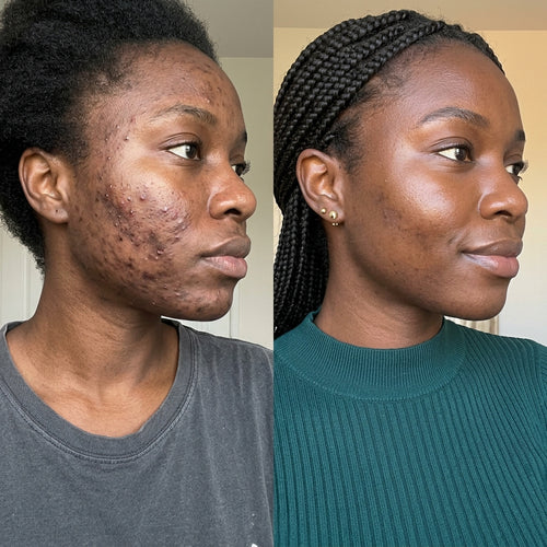 GHK-Cu Peptides Serum - GLOWLESS