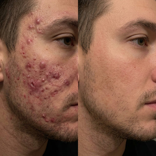 GHK-Cu Peptides Serum - GLOWLESS