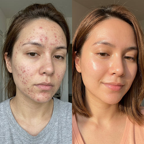 GHK-Cu Peptides Serum - GLOWLESS